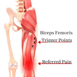 Can Tight Hamstrings Cause Knee Pain? The Answer Might Surprise You ...