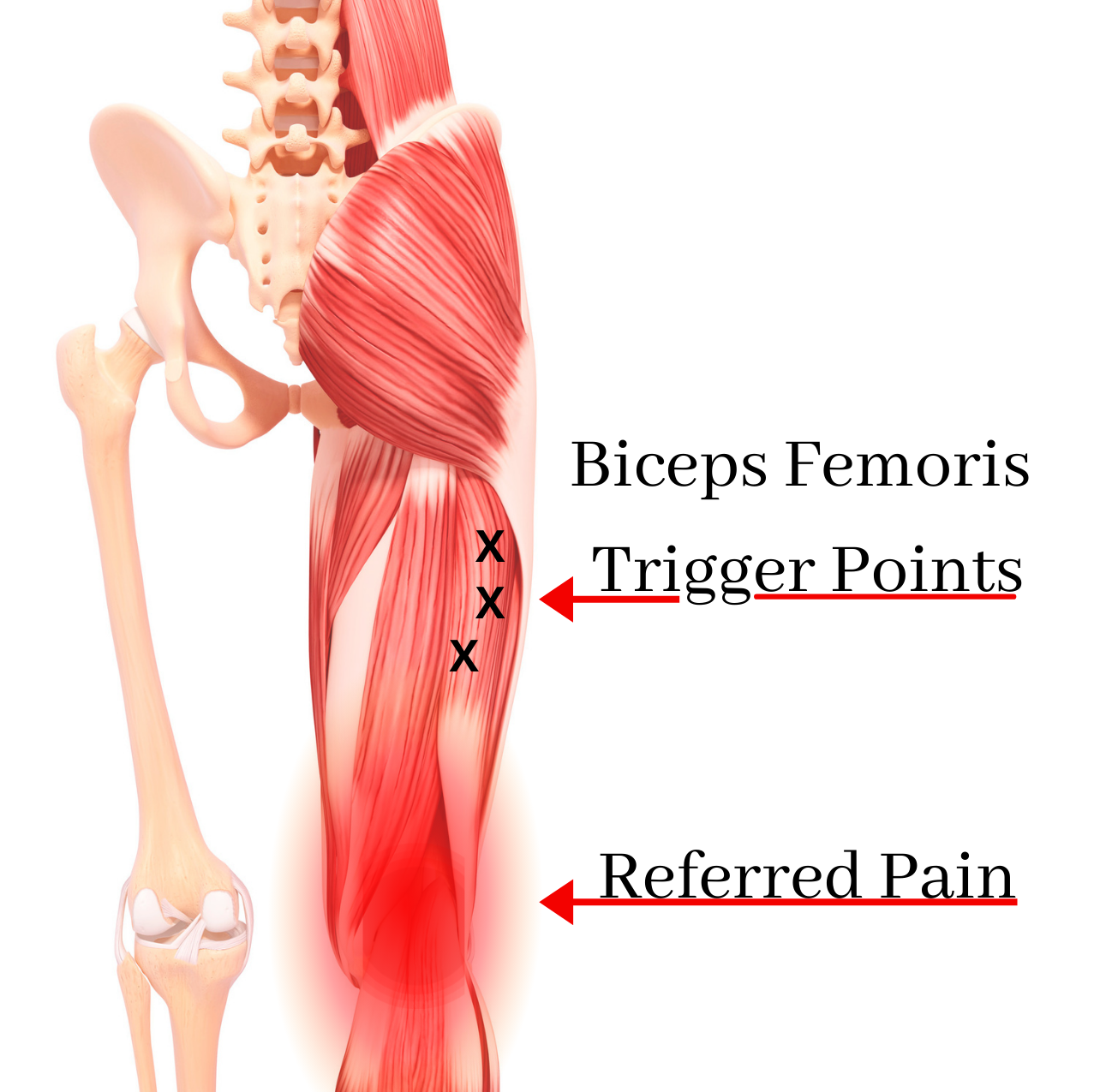 can-tight-hamstrings-cause-knee-pain-the-answer-might-surprise-you