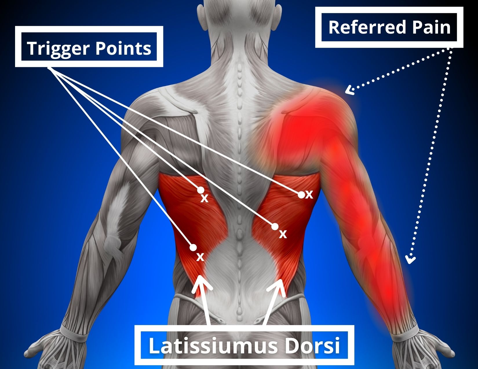 7 Causes Of Shoulder Pain And Tingling In The Fingers Facts Physio