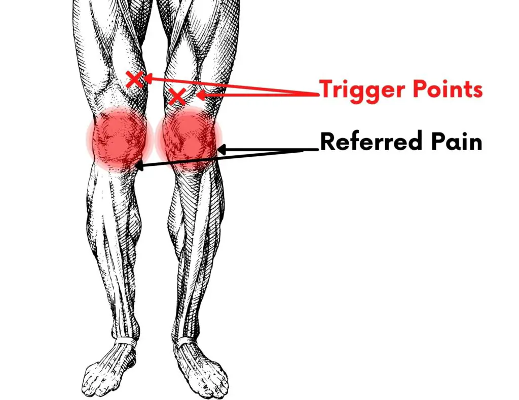 Sharp Pain Below Knee Cap When Walking at Franklin Elledge blog