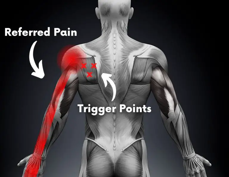 7 Causes of Shoulder Pain and Tingling in the Fingers - Facts & Physio