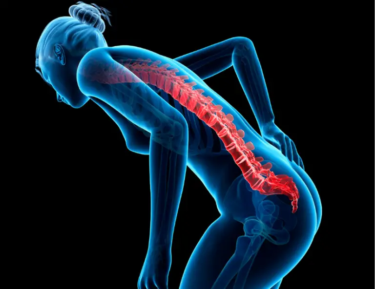 Low Back Lumbar Spine Pain Woman Bent Forward Holding Lower Back Can't Straighten Up