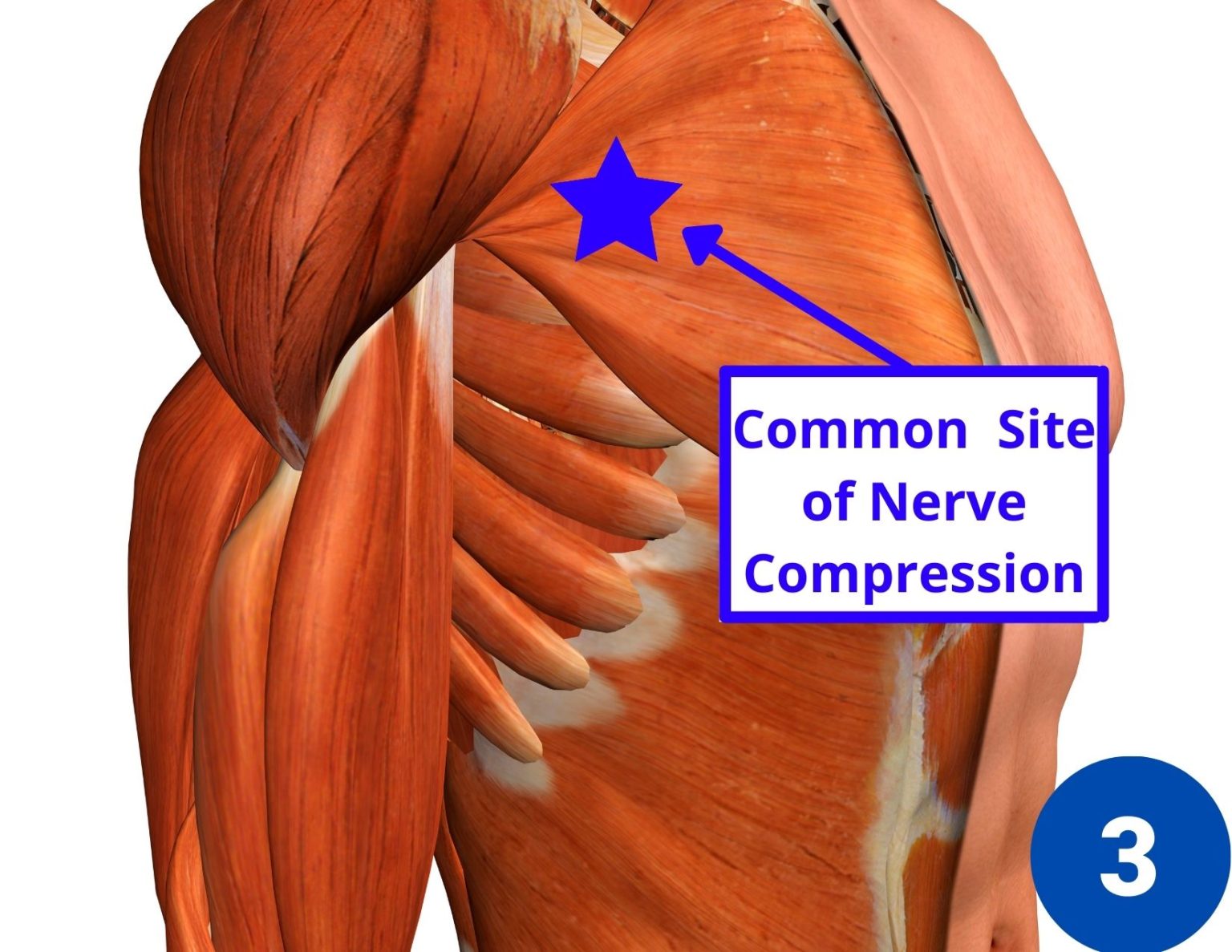 7 Causes of Shoulder Pain and Tingling in the Fingers - Facts & Physio