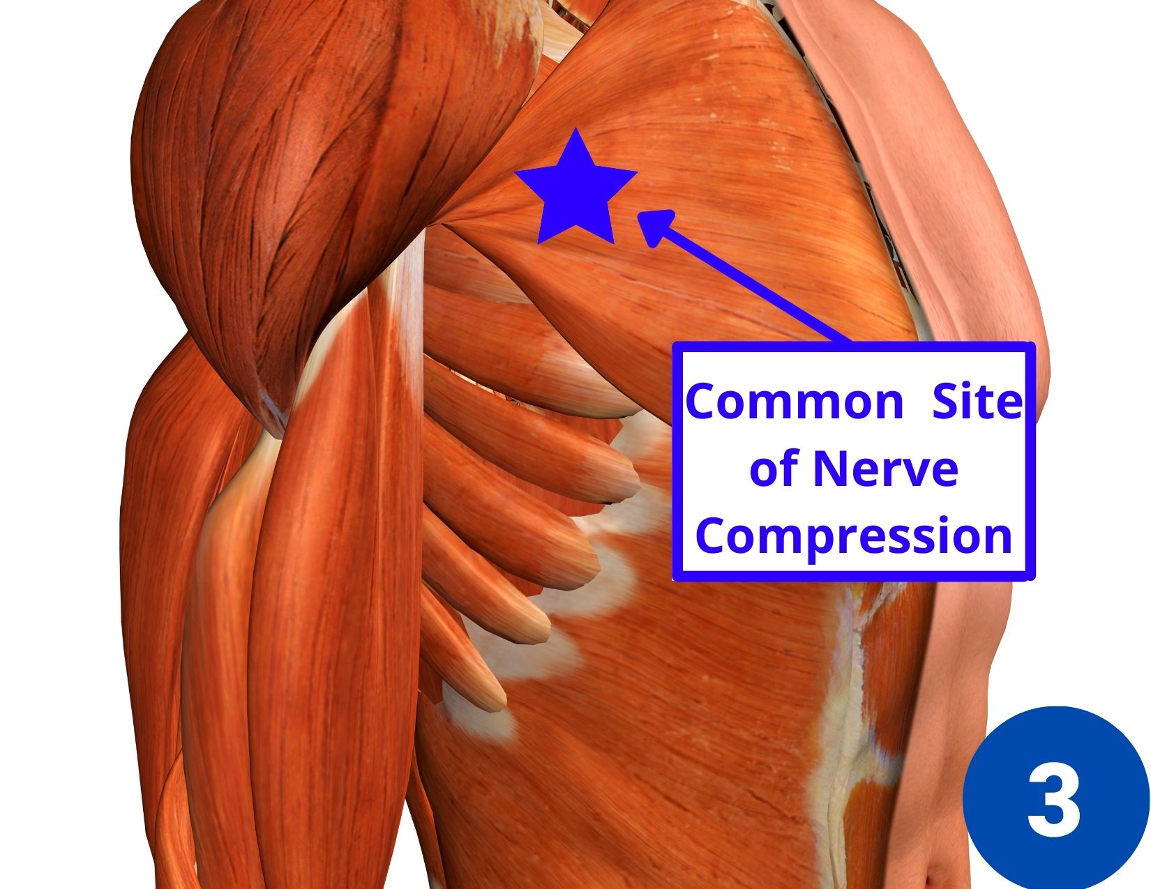 7-causes-of-shoulder-pain-and-tingling-in-the-fingers-facts-physio