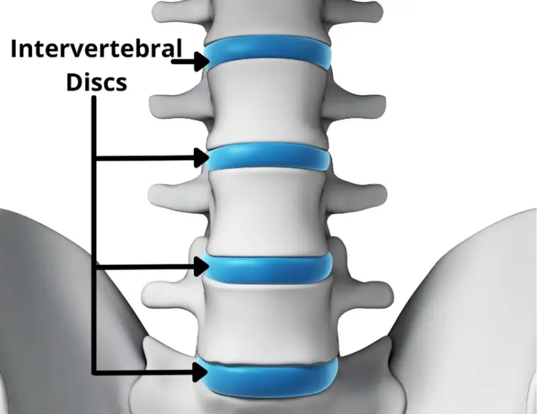 Why Bulging Discs Are No Big Deal (Usually) - Facts & Physio