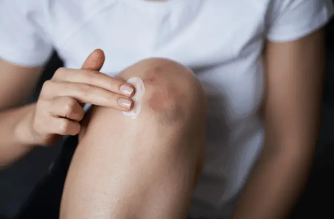 woman rubbing cream on her knee to illustrate pain and placebo relationship example 